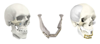 PS2 the 外科医. The cirugiao PS2 the 外科医. The cirugiao